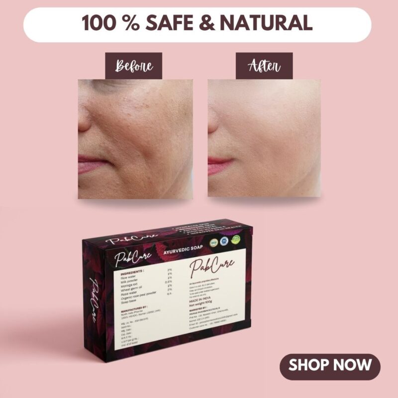 Pabcure Rice & Rose Water Soap with Moringa and Wheat germ oil-100gm (Korean Soap) - Image 5